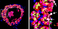 lung cells in an organoid